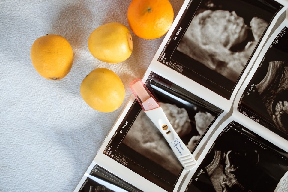 Hilarious Fake Pregnancy Ultrasound Prank Ideas to Try with Friends